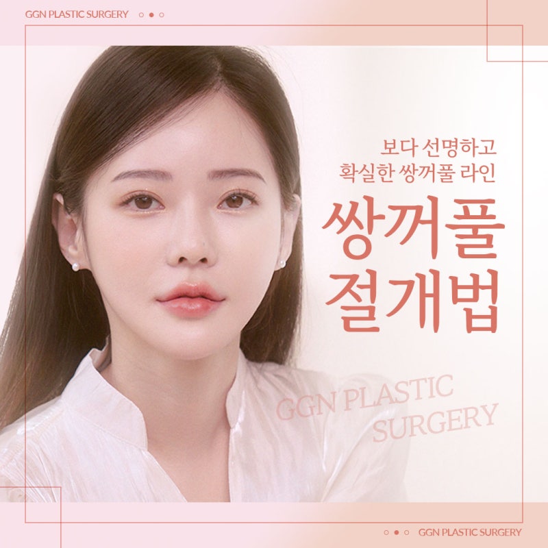 [강남 쌍꺼풀 수술]쌍꺼풀 절개법이란?