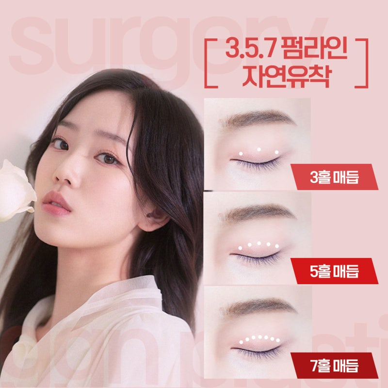 [강남 눈성형]자연유착 쌍꺼풀 매몰법의 모든것! 사진 4