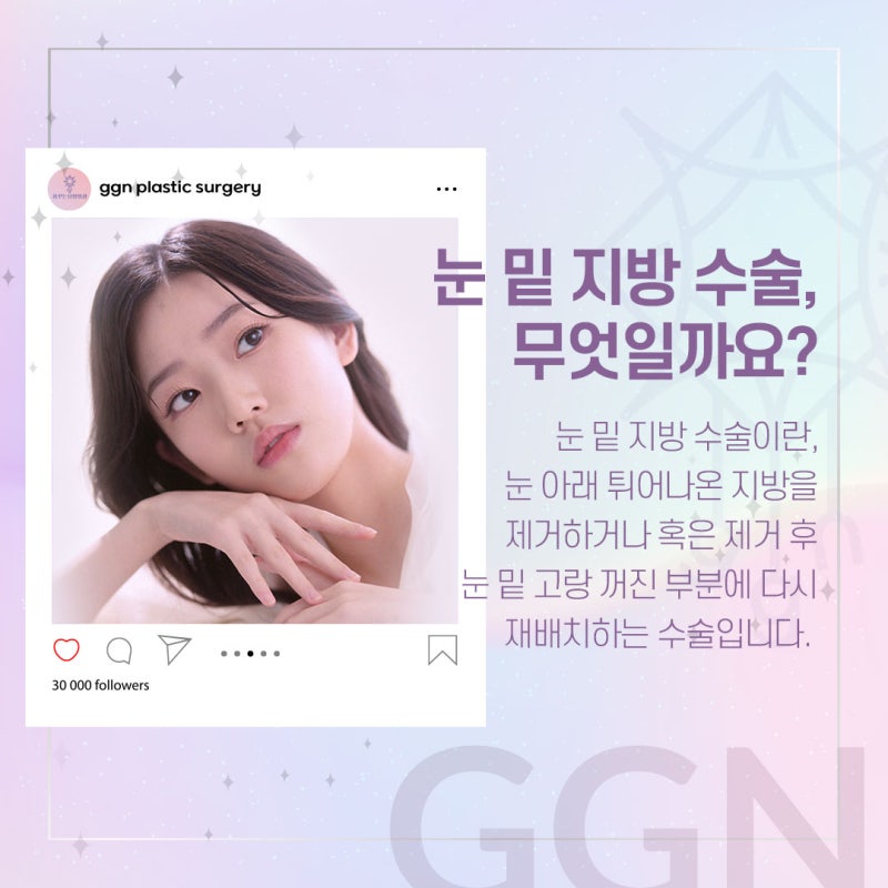 [강남 눈밑지방재배치] 다크서클이 고민이 되세요?