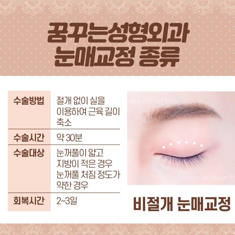 [강남 눈성형] 시원하고 또렷한 눈매교정!