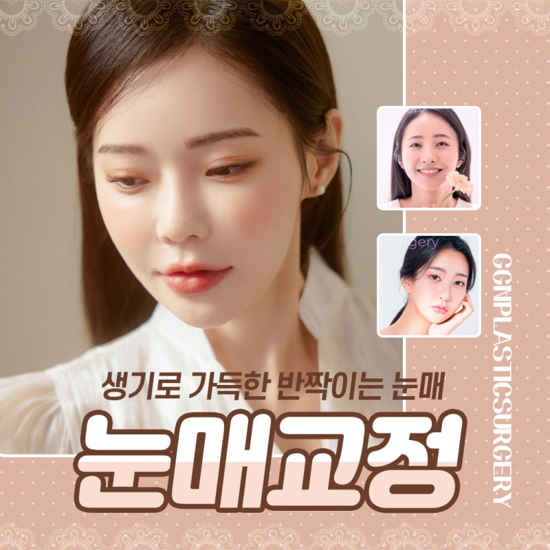 [강남 눈성형] 시원하고 또렷한 눈매교정!