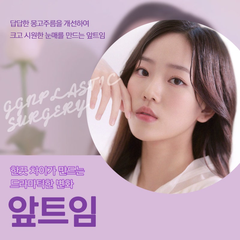 [강남 눈성형] 트임성형은 어떻게 진행될까요?