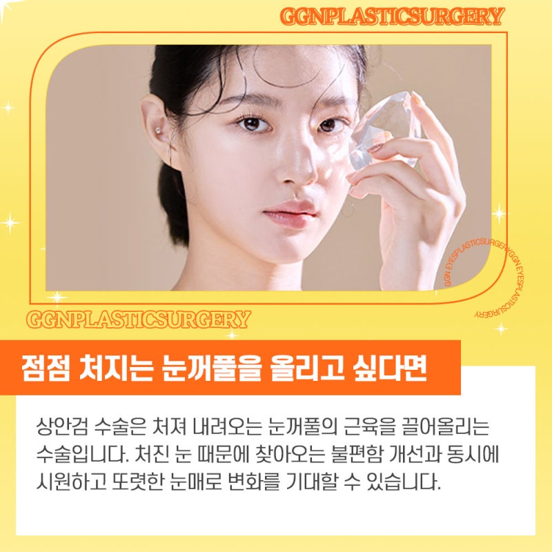 [강남 눈성형] 상안검수술 추천 병원! 사진 2