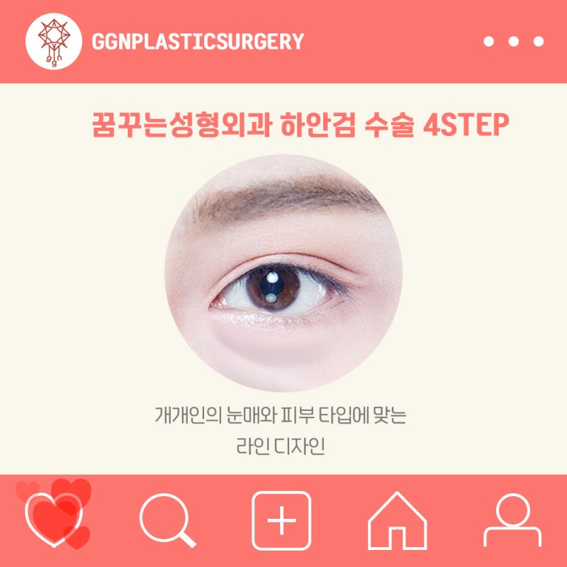 [강남 눈성형] 하안검 수술 잘하는 곳?!