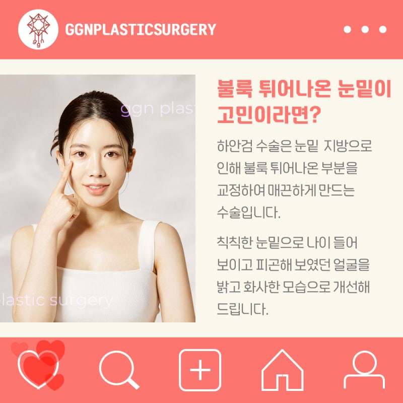 [강남 눈성형] 하안검 수술 잘하는 곳?! 사진 2