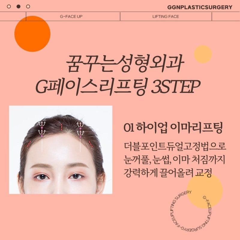 [강남 리프팅] 시간을 되돌리는 하이업G페이스
