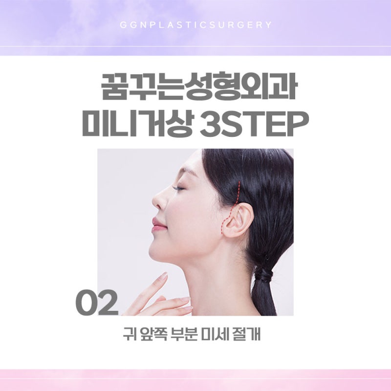 [강남 리프팅] 깊은주름개선에 효과적인 이것! 사진 4