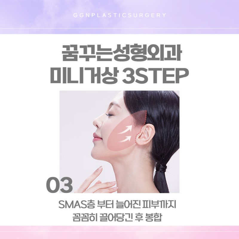 [강남 리프팅] 깊은주름개선에 효과적인 이것! 사진 5