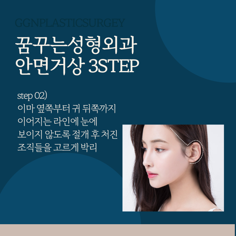 [강남 리프팅] 얼굴 처짐 개선에 강력한 효과를 주는 비법! 사진 5