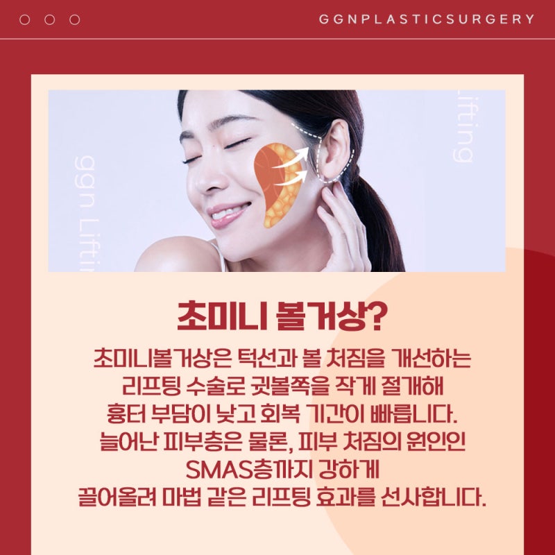 [강남 리프팅] 턱선과 볼처짐이 걱정이세요? 사진 2