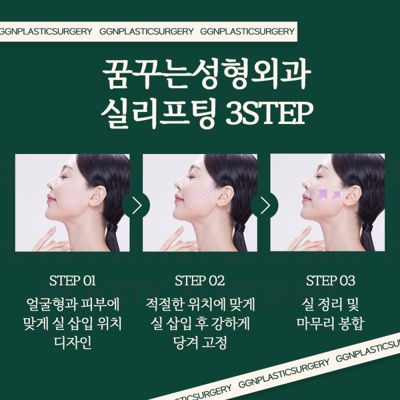 [강남 리프팅] V라인이 되고 싶을 땐? 실리프팅! 사진 5