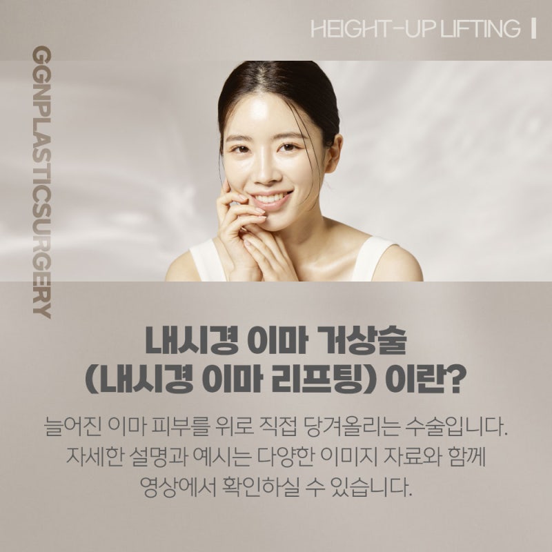 [강남 리프팅] 이마 주름개선엔 하이업 이마리프팅! 사진 2
