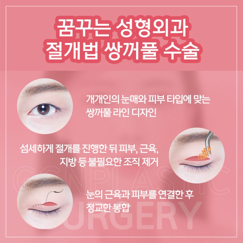 [강남 꿈꾸는성형외과] 예쁜 쌍꺼풀 모양과 조화로운 얼굴 사진 4