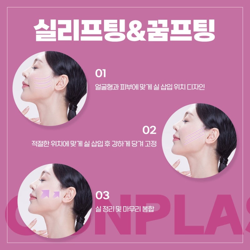 [강남 꿈꾸는성형외과] 내 얼굴의 탄력을 위해 리프팅! 사진 3