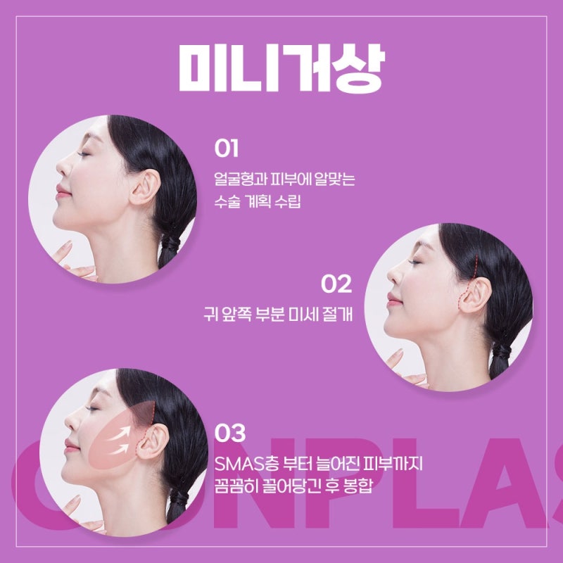 [강남 꿈꾸는성형외과] 내 얼굴의 탄력을 위해 리프팅! 사진 7