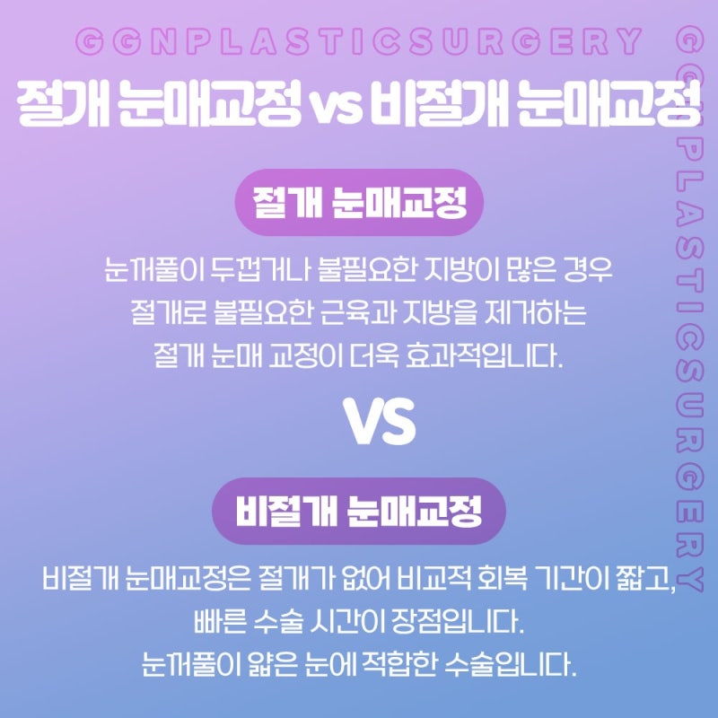 [강남 꿈꾸는성형외과] 자연스러운 쌍꺼풀과 눈매교정!