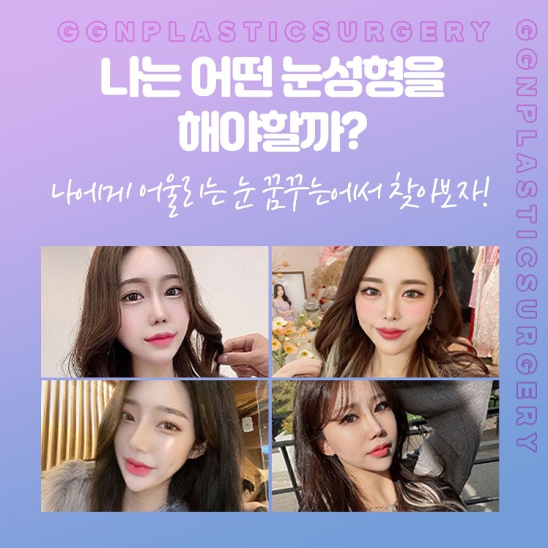 [강남 꿈꾸는성형외과] 자연스러운 쌍꺼풀과 눈매교정! 사진 7