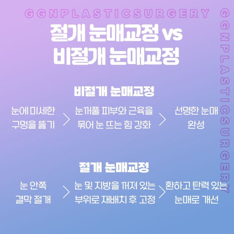 [강남 꿈꾸는성형외과] 자연스러운 쌍꺼풀과 눈매교정! 사진 5