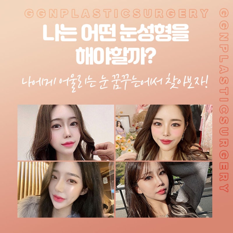 [강남 눈성형]쌍커풀과 눈매교정 어떤걸 해야할까? 사진 2