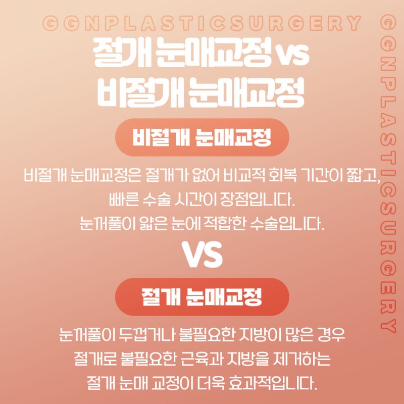 [강남 눈성형]쌍커풀과 눈매교정 어떤걸 해야할까? 사진 6