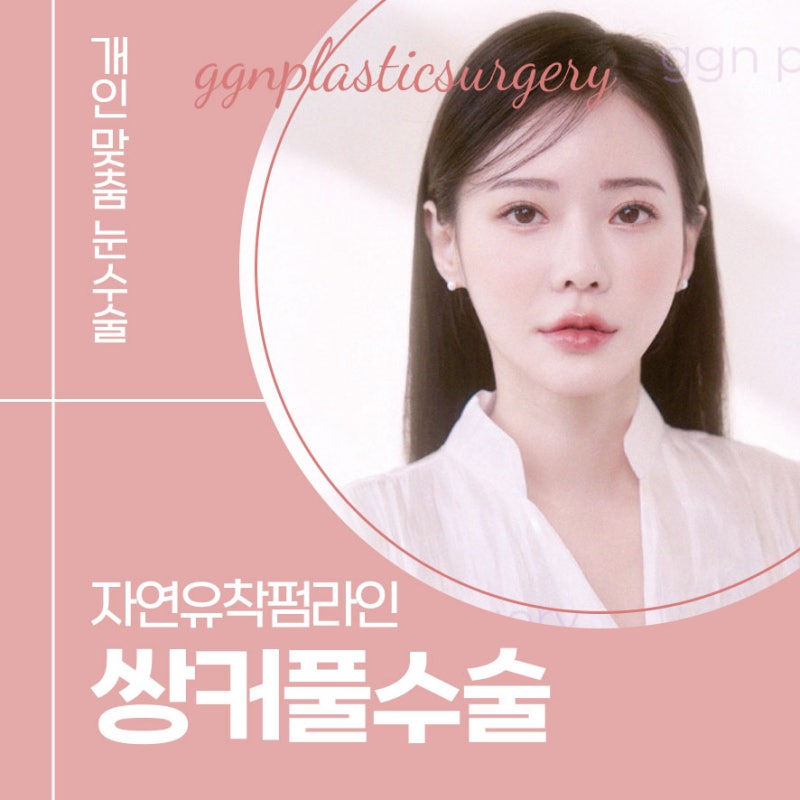 [강남 눈성형] 풀리지 않는 자연스러운 쌍꺼풀라인, 자연유착펌라인