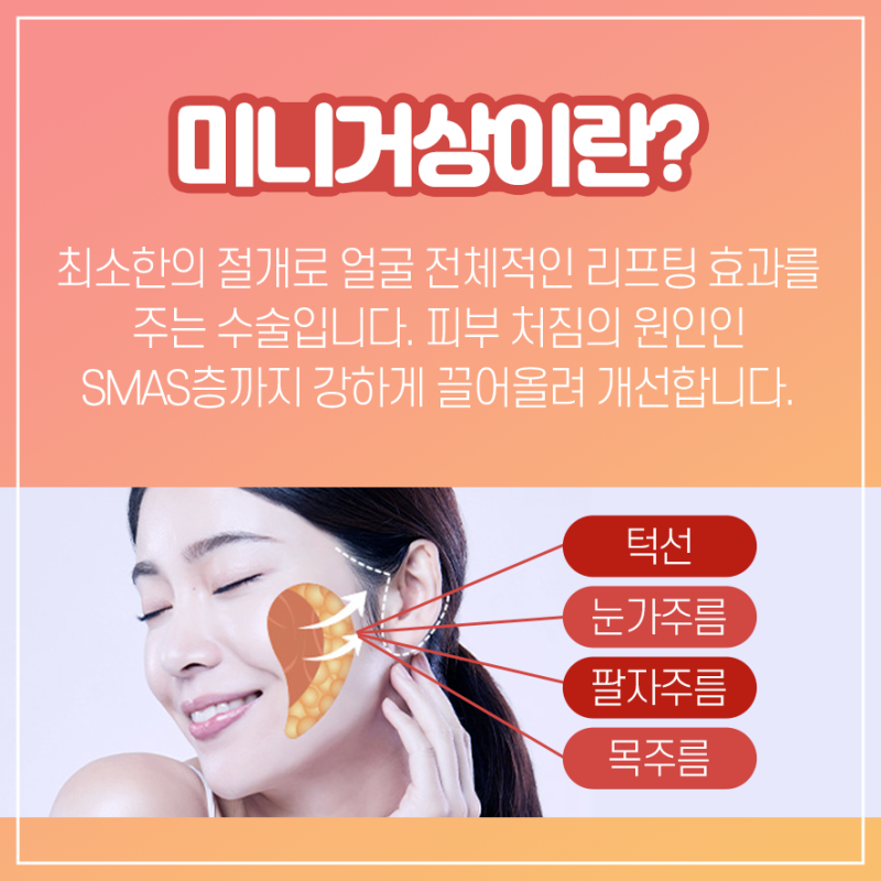 [강남 리프팅] 세월의 흔적을 지우는 미니거상