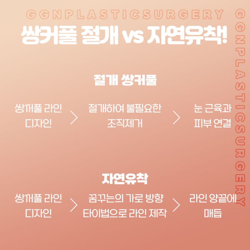 [강남 눈성형] 선명하고 확실한 쌍꺼풀&생기로 가득한 반짝이는 눈매교정 사진 3