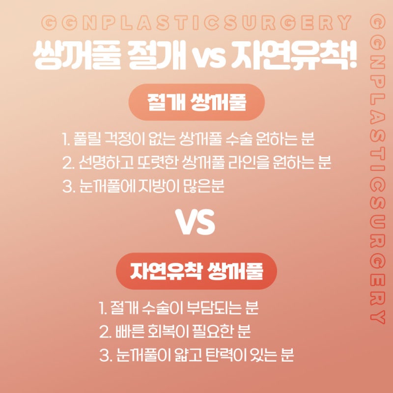 [강남 눈성형] 선명하고 확실한 쌍꺼풀&생기로 가득한 반짝이는 눈매교정 사진 4