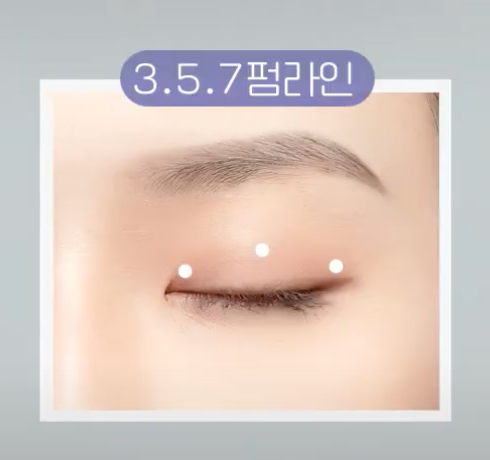 [강남 꿈꾸는 성형외과] 자연스러운 쌍꺼풀을 갖고싶어요! 사진 4