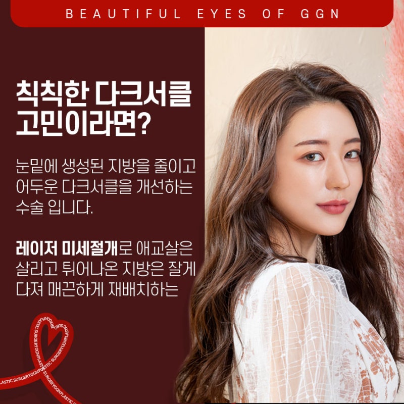 [강남 눈성형] 칙칙한 다크서클 고민엔 눈밑지방재배치