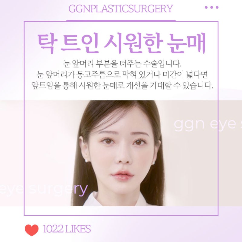 [강남 눈성형] 크고 시원한 눈매를 만들어주는 앞트임!