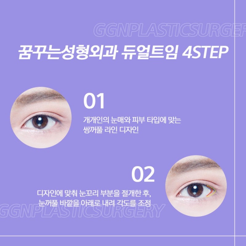 [강남 눈성형] 꿈꾸는 성형외과의 수험생을 위한 듀얼트임 EVENT!!!(11월 18일~12월 17일)