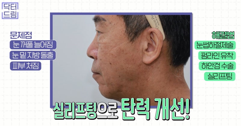 [강남 꿈꾸는 성형외과] 60대 부부, 성형 수술로 새로운 인생 시작! 사진 9