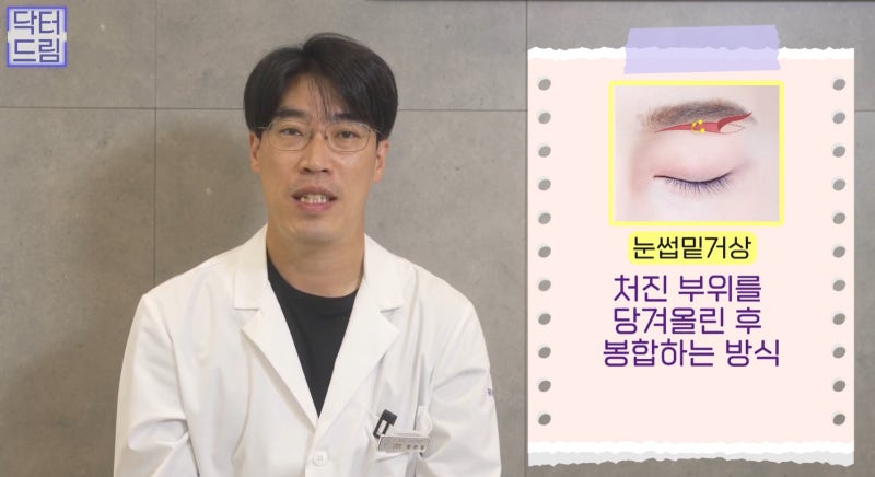 [강남 꿈꾸는 성형외과] 내 눈에 딱 맞는 눈 수술(자가진단법!) 사진 8