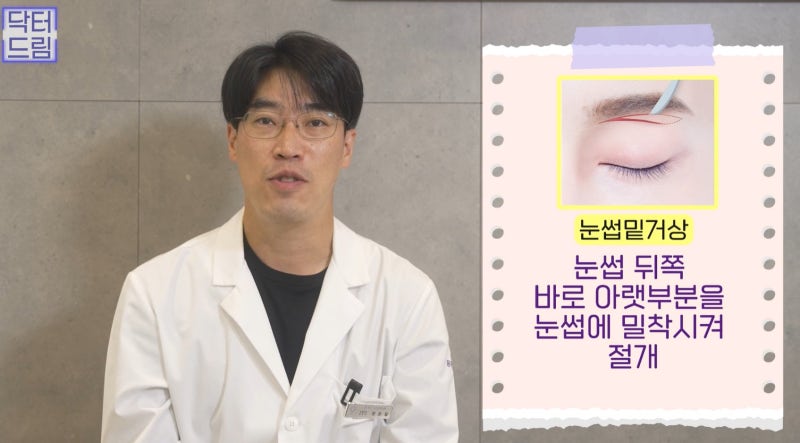 [강남 꿈꾸는 성형외과] 내 눈에 딱 맞는 눈 수술(자가진단법!) 사진 7