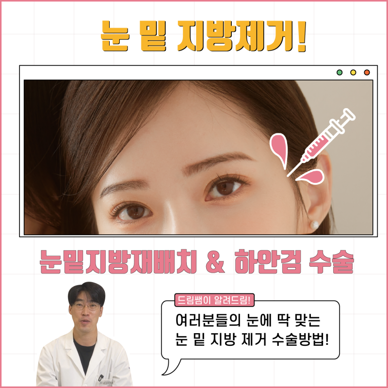 [강남 꿈꾸는 성형외과] 내 눈에 딱 맞는 눈 밑 지방제거!