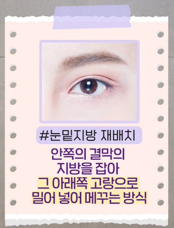 [강남 꿈꾸는 성형외과] 내 눈에 딱 맞는 눈 밑 지방제거! 사진 10