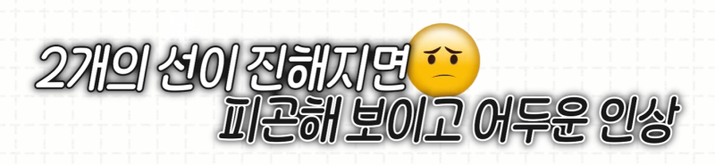 [강남 꿈꾸는 성형외과] 내 눈에 딱 맞는 눈 밑 지방제거! 사진 5