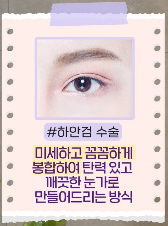 [강남 꿈꾸는 성형외과] 내 눈에 딱 맞는 눈 밑 지방제거! 사진 13