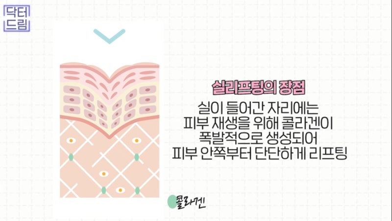 [강남꿈꾸는성형외과] 2023년 주목해야 할 성형 트렌드 TOP3!