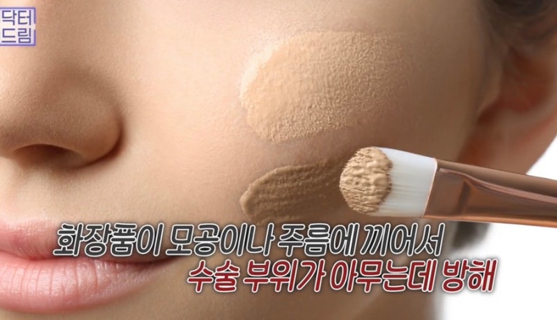 [강남꿈꾸는성형외과] 성형수술을 준비/진행하는 분들 주목! 성형 수술 후 주의사항! 사진 11