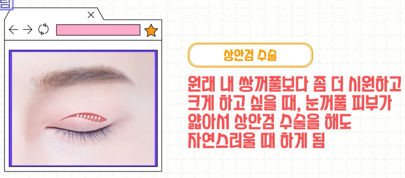 [강남 꿈꾸는성형외과] 족집게 과외 / 나에게 맞는 안티에이징 찾아드림!! 사진 15