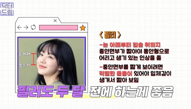 [강남 꿈꾸는 성형외과] 웨딩시즌! 결혼 전 준비해야 할 성형 꿀팁 2탄(3개월 ~ 본식 당일) 사진 17