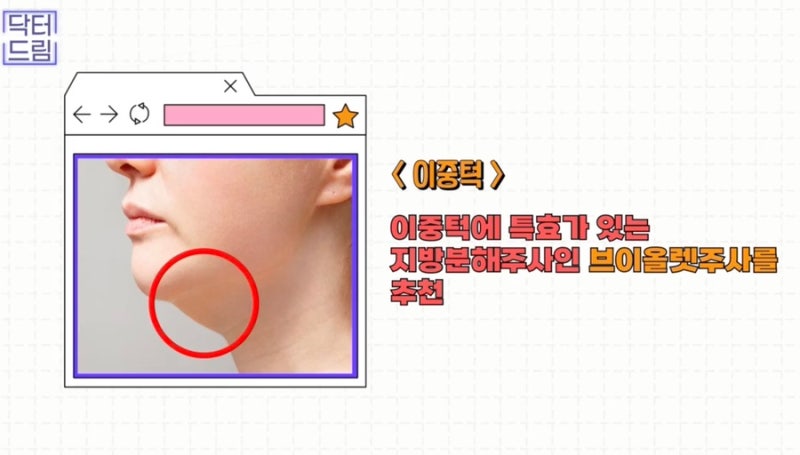 [강남 꿈꾸는 성형외과] 웨딩시즌! 결혼 전 준비해야 할 성형 꿀팁 2탄(3개월 ~ 본식 당일) 사진 9