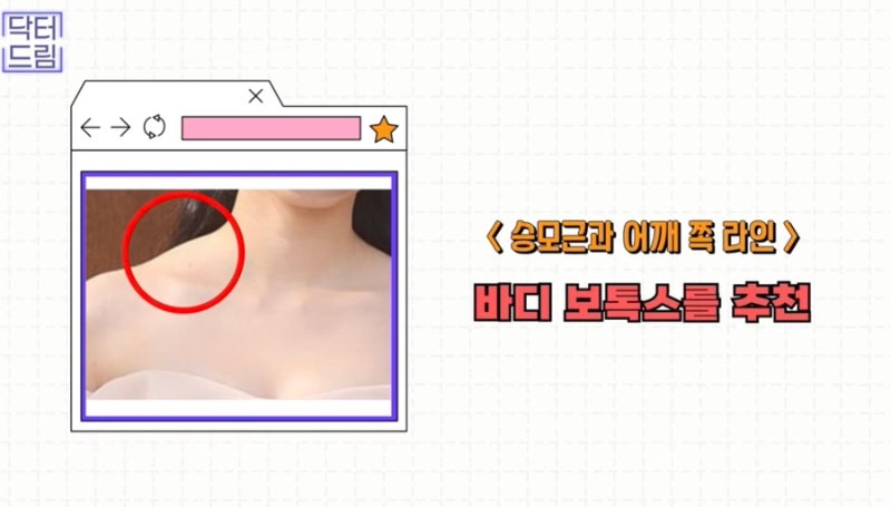 [강남 꿈꾸는 성형외과] 웨딩시즌! 결혼 전 준비해야 할 성형 꿀팁 2탄(3개월 ~ 본식 당일) 사진 10