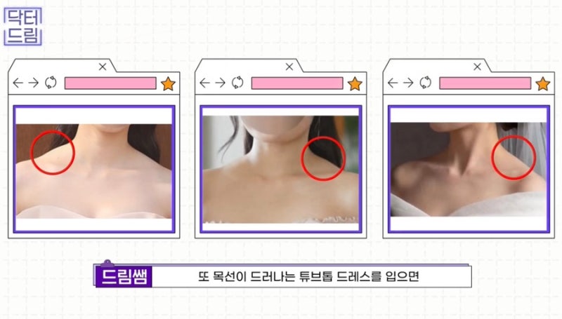 [강남 꿈꾸는 성형외과] 웨딩시즌! 결혼 전 준비해야 할 성형 꿀팁 2탄(3개월 ~ 본식 당일) 사진 4