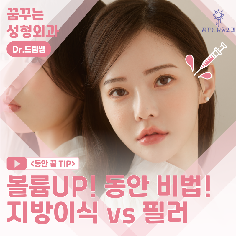 [강남 꿈꾸는 성형외과] 동안 비법 ㅣ 지방이식 vs 필러 시술