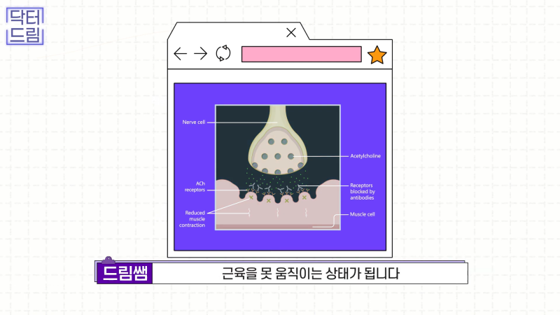 [강남 꿈꾸는 성형외과] 보톡스와 필러의 차이점! 사진 10