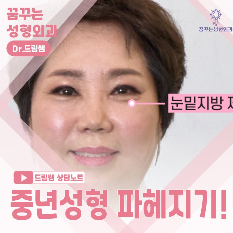 [강남꿈꾸는성형외과] 드림쌤 '중년 여성 성형' 상담 노트!