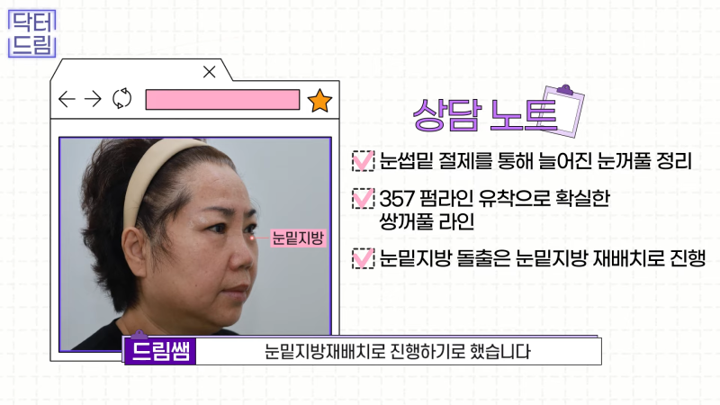 [강남꿈꾸는성형외과] 드림쌤 '중년 여성 성형' 상담 노트! 사진 12